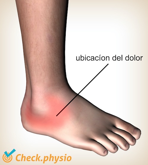 tobillo ligamento lateral del tobillo lesión dolor localización traumatismo por inversión